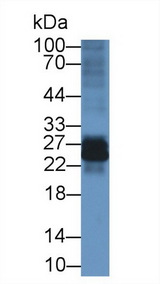 IL-22BP / IL22RA2 Antibody - Western Blot; Sample: Rat Spleen lysate; Primary Ab: 3µg/ml Rabbit Anti-Mouse IL22Ra2 Antibody Second Ab: 0.2µg/mL HRP-Linked Caprine Anti-Rabbit IgG Polyclonal Antibody