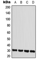 IL-22BP / IL22RA2 Antibody - Western blot analysis of IL-22RA2 expression in HeLa (A); MCF7 (B); mouse heart (C); rat heart (D) whole cell lysates.