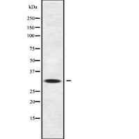 IL-22BP / IL22RA2 Antibody - Western blot analysis IL22RA2 using HepG2 whole cells lysates