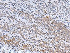 IL-22BP / IL22RA2 Antibody - Immunohistochemistry of paraffin-embedded Human tonsil tissue  using IL22RA2 Polyclonal Antibody at dilution of 1:70(×200)