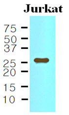 IL-33 Antibody - The Cell lysates of Jurkat (35 ug) were resolved by SDS-PAGE, transferred to NC membrane and probed with anti-human IL-33 (1:500). Proteins were visualized using a goat anti-mouse secondary antibody conjugated to HRP and an ECL detection system.