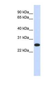IL-33 Antibody - IL33 / IL-33 antibody Western blot of 293T cell lysate. This image was taken for the unconjugated form of this product. Other forms have not been tested.