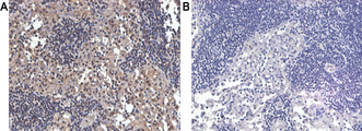 IL-33 Antibody - Immunohistochemical staining of human lymph node tissue using A) anti-IL-33 (human), pAb and B) anti-rabbit IgG (negative control) .  This image was taken for the unconjugated form of this product. Other forms have not been tested.