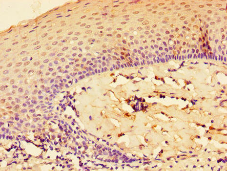 IL-33 Antibody - Immunohistochemistry of paraffin-embedded human tonsil tissue using IL33 Antibody at dilution of 1:100