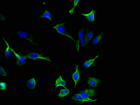 IL-33 Antibody - Immunofluorescent analysis of Hela cells using IL33 Antibody at a dilution of 1:100 and Alexa Fluor 488-congugated AffiniPure Goat Anti-Rabbit IgG(H+L)