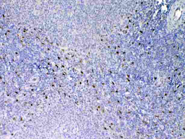 IL-33 Antibody - IHC analysis of IL33 using anti-IL33 antibody. IL33 was detected in paraffin-embedded section of rat spleen tissue. Heat mediated antigen retrieval was performed in citrate buffer (pH6, epitope retrieval solution) for 20 mins. The tissue section was blocked with 10% goat serum. The tissue section was then incubated with 1µg/ml rabbit anti-IL33 Antibody overnight at 4°C. Biotinylated goat anti-rabbit IgG was used as secondary antibody and incubated for 30 minutes at 37°C. The tissue section was developed using Strepavidin-Biotin-Complex (SABC) with DAB as the chromogen.