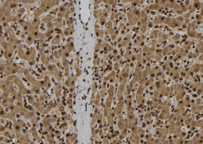 IL-33 Antibody - 1:100 staining human liver tissue by IHC-P. The sample was formaldehyde fixed and a heat mediated antigen retrieval step in citrate buffer was performed. The sample was then blocked and incubated with the antibody for 1.5 hours at 22°C. An HRP conjugated goat anti-rabbit antibody was used as the secondary.