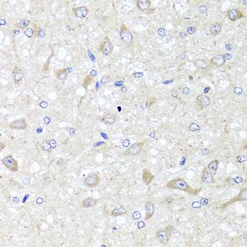 IL-33 Antibody - Immunohistochemistry of paraffin-embedded Rat brain using IL33 Polyclonal Antibody at dilution of 1:100 (40x lens).