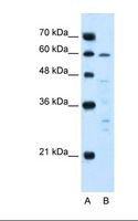 IL10RA Antibody - Lane A: Marker. Lane B: Jurkat cell lysate. Antibody concentration: 5.0 ug/ml. Gel concentration: 12%.  This image was taken for the unconjugated form of this product. Other forms have not been tested.