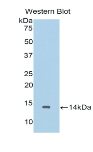 IL10RA Antibody - Western blot of recombinant IL10RA.  This image was taken for the unconjugated form of this product. Other forms have not been tested.