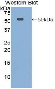 IL10RA Antibody - Western blot of recombinant IL10RA.  This image was taken for the unconjugated form of this product. Other forms have not been tested.