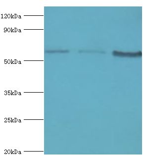 IL10RA Antibody - Western blot. All lanes: Interleukin-10 receptor subunit alpha antibody at 8 ug/ml. Lane 1: mouse heart tissue. Lane 2: HeLa whole cell lysate. Lane 3: mouse liver tissue. secondary Goat polyclonal to rabbit at 1:10000 dilution. Predicted band size: 63 kDa. Observed band size: 63 kDa.