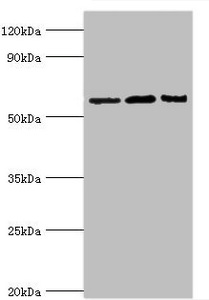 IL10RA Antibody - Western blot All lanes: Interleukin-10 receptor subunit alpha antibody at 8µg/ml Lane 1: Mouse heart tissue Lane 2: Hela whole cell lysate Lane 3: Mouse liver tissue Secondary Goat polyclonal to rabbit IgG at 1/10000 dilution Predicted band size: 63 kDa Observed band size: 63 kDa