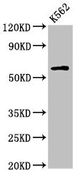 IL10RA Antibody - Western Blot Positive WB detected in:K562 whole cell lysate All Lanes:IL10RA antibody at 2.7µg/ml Secondary Goat polyclonal to rabbit IgG at 1/50000 dilution Predicted band size: 64 KDa Observed band size: 64 KDa
