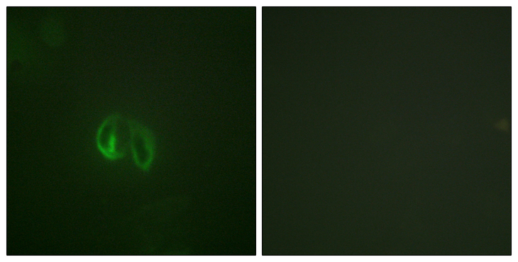 IL10RA Antibody - Immunofluorescence analysis of HepG2 cells, using IL-10R alpha Antibody. The picture on the right is blocked with the synthesized peptide.