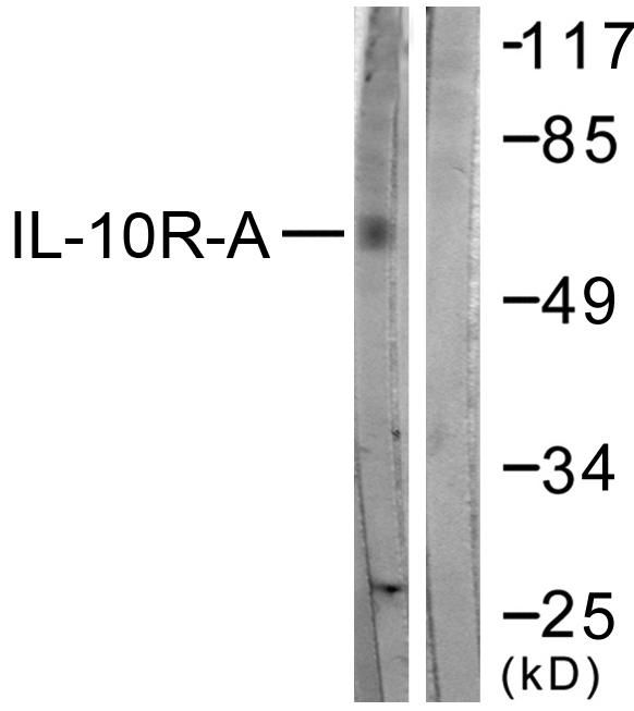IL10RA Antibody - Western blot analysis of lysates from HepG2 cells, treated with Na2VO3 0.3nM 40', using IL-10R alpha Antibody. The lane on the right is blocked with the synthesized peptide.