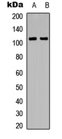 IL10RA Antibody - Western blot analysis of CD210a expression in HUVEC (A); HEK293T (B) whole cell lysates.