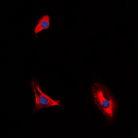 IL10RA Antibody - Immunofluorescent analysis of CD210a staining in HUVEC cells. Formalin-fixed cells were permeabilized with 0.1% Triton X-100 in TBS for 5-10 minutes and blocked with 3% BSA-PBS for 30 minutes at room temperature. Cells were probed with the primary antibody in 3% BSA-PBS and incubated overnight at 4 ??C in a humidified chamber. Cells were washed with PBST and incubated with a DyLight 594-conjugated secondary antibody (red) in PBS at room temperature in the dark. DAPI was used to stain the cell nuclei (blue).