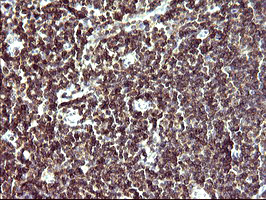 IL10RA Antibody - IHC of paraffin-embedded Human lymph node tissue using anti-IL10RA mouse monoclonal antibody. (Heat-induced epitope retrieval by 10mM citric buffer, pH6.0, 120°C for 3min). At a dilution of 1:150. 