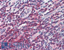 IL10RA Antibody - Human Small Intestine, MALT: Formalin-Fixed, Paraffin-Embedded (FFPE), at a concentration of 10 ug/ml. 