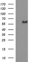 IL10RA Antibody - HEK293T cells were transfected with the pCMV6-ENTRY control (Left lane) or pCMV6-ENTRY IL10RA (Right lane) cDNA for 48 hrs and lysed. Equivalent amounts of cell lysates (5 ug per lane) were separated by SDS-PAGE and immunoblotted with anti-IL10RA.