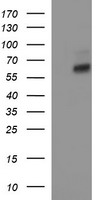 IL10RA Antibody - HEK293T cells were transfected with the pCMV6-ENTRY control (Left lane) or pCMV6-ENTRY IL10RA (Right lane) cDNA for 48 hrs and lysed. Equivalent amounts of cell lysates (5 ug per lane) were separated by SDS-PAGE and immunoblotted with anti-IL10RA.