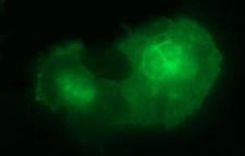 IL10RA Antibody - Anti-IL10RA mouse monoclonal antibody immunofluorescent staining of COS7 cells transiently transfected by pCMV6-ENTRY IL10RA.