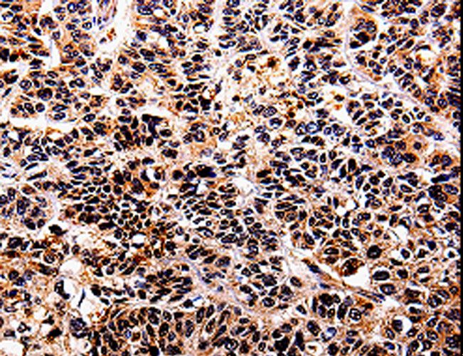 IL10RA Antibody - Immunohistochemistry of paraffin-embedded Human tonsil using IL10RA Polyclonal Antibody at dilution of 1:30.