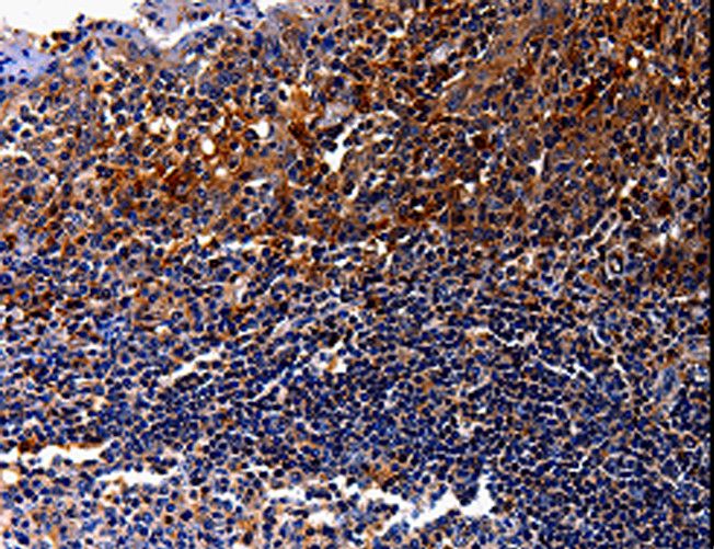 IL10RA Antibody - Immunohistochemistry of paraffin-embedded Human tonsil using IL10RA Polyclonal Antibody at dilution of 1:30.