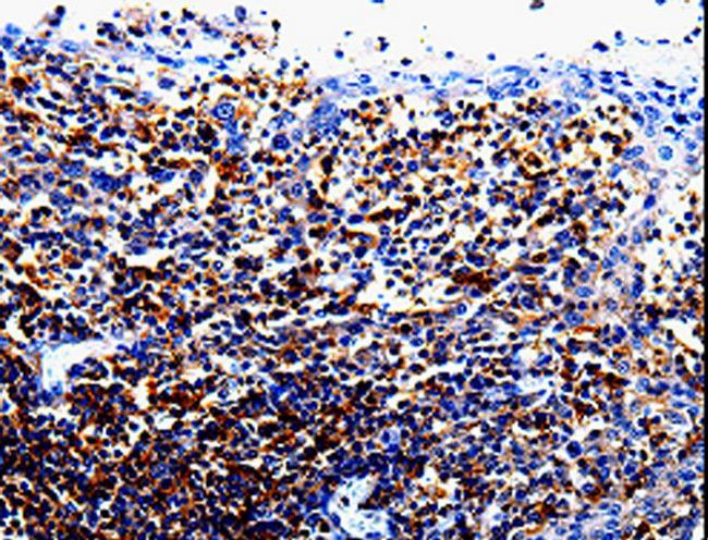 IL10RA Antibody - Immunohistochemistry of paraffin-embedded Human tonsil using IL10RA Polyclonal Antibody at dilution of 1:60.