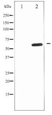 IL10RA Antibody - Western blot of IL-10R alpha expression in Na2VO3 treated HepG2 whole cell lysates,The lane on the left is treated with the antigen-specific peptide.