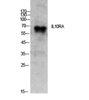 IL10RA Antibody - Western Blot analysis of extracts from PC12 cells using IL10RA Antibody.