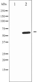 IL10RA Antibody - Western blot analysis of IL-10R alpha expression in Na2VO3 treated HepG2 whole cells lysates. The lane on the left is treated with the antigen-specific peptide.