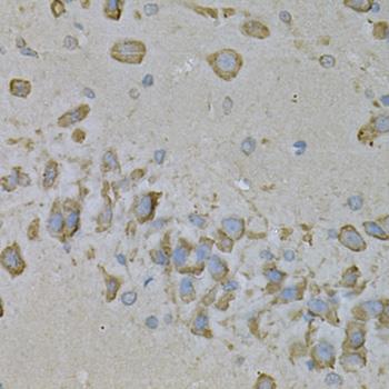 IL10RA Antibody - Immunohistochemistry of paraffin-embedded Mouse brain using IL10RA Polyclonal Antibody at dilution of 1:100 (40x lens).
