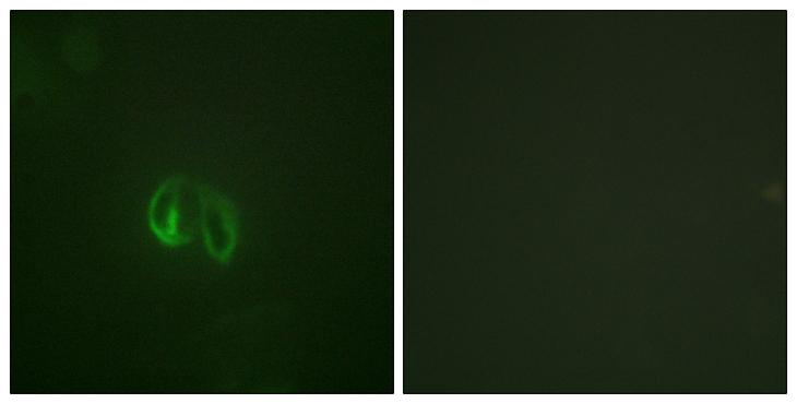 IL10RA Antibody - Peptide - + Immunofluorescence analysis of HepG2 cells, using IL-10Ra (Ab-496) antibody.
