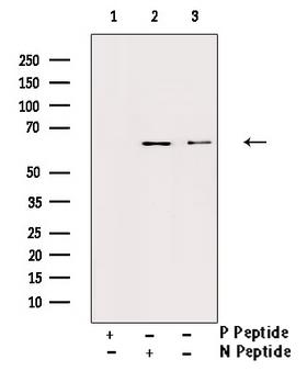IL10RA Antibody - Western blot analysis of Phospho-IL-10R alpha (Tyr496) antibody expression in HuvEc cells lysates. The lane on the right is treated with the antigen-specific peptide.