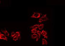 IL10RA Antibody - Staining HuvEc cells by IF/ICC. The samples were fixed with PFA and permeabilized in 0.1% Triton X-100, then blocked in 10% serum for 45 min at 25°C. The primary antibody was diluted at 1:200 and incubated with the sample for 1 hour at 37°C. An Alexa Fluor 594 conjugated goat anti-rabbit IgG (H+L) Ab, diluted at 1/600, was used as the secondary antibody.