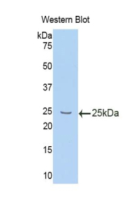IL10RB Antibody - Western blot of recombinant IL10RB / IL-10R2.  This image was taken for the unconjugated form of this product. Other forms have not been tested.
