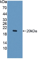 IL10RB Antibody - Western Blot; Sample: Recombinant IL10Rb, Human.