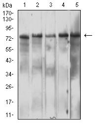 IL10RB Antibody - Western blot analysis using IL10RB mouse mAb against Hela (1), Jurkat (2), Ramos (3), Raji (4), and C6 (5) cell lysate.