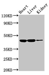 IL10RB Antibody - Positive Western Blot detected in Rat heart tissue, Rat liver tissue, Rat kidney tissue. All lanes: IL10RB antibody at 2 µg/ml Secondary Goat polyclonal to rabbit IgG at 1/50000 dilution. Predicted band size: 37 KDa. Observed band size: 45 KDa
