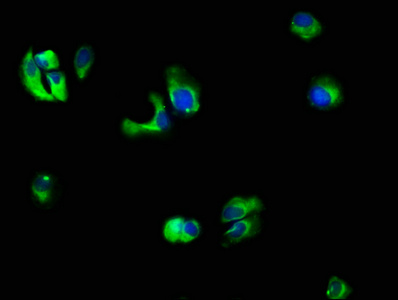 IL10RB Antibody - Immunofluorescence staining of MCF-7 cells with IL10RB Antibody at 1:66, counter-stained with DAPI. The cells were fixed in 4% formaldehyde, permeabilized using 0.2% Triton X-100 and blocked in 10% normal Goat Serum. The cells were then incubated with the antibody overnight at 4°C. The secondary antibody was Alexa Fluor 488-congugated AffiniPure Goat Anti-Rabbit IgG(H+L).