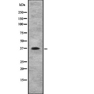 IL10RB Antibody - Western blot analysis IL10RB using COLO205 whole cells lysates