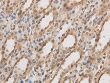IL10RB Antibody - Immunohistochemistry of paraffin-embedded Rat kidney using IL10RB Polyclonal Antibody at dilution of 1:50.