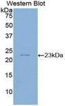 IL11 Antibody - Western blot of recombinant IL11.  This image was taken for the unconjugated form of this product. Other forms have not been tested.