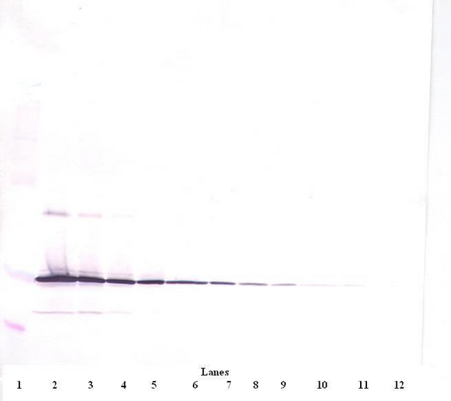 IL11 Antibody - Anti-Human IL-11 Western Blot Reduced