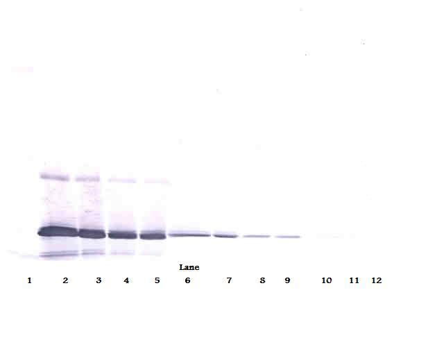 IL11 Antibody - Western Blot (reducing) of IL-11 antibody