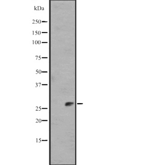 IL11 Antibody - Western blot analysis of IL11 expression in human Plasma Total Protein Lysate. The lane on the left is treated with the antigen-specific peptide.
