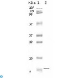 IL11 Antibody - Western Blot (WB) analysis using IL-11 Monoclonal Antibody against truncated IL-11 recombinant protein.