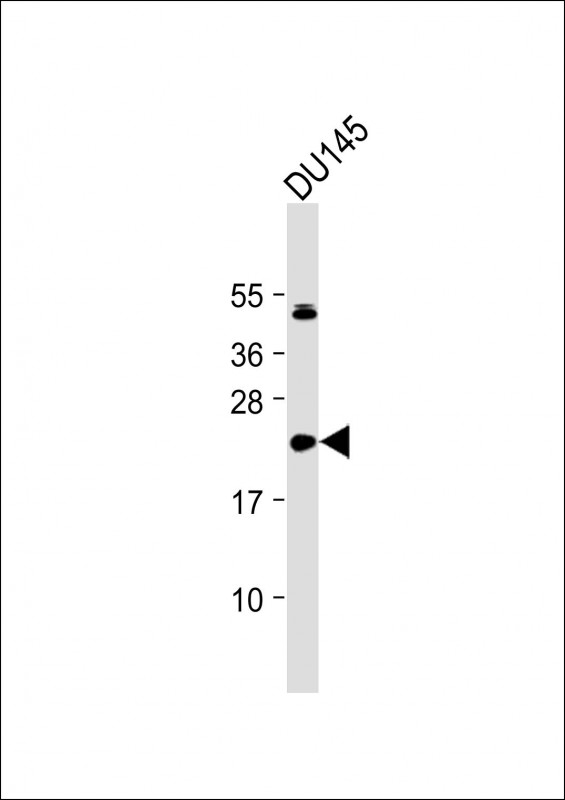 IL11 Antibody - Anti-IL11 Antibody (N-Term) at 1:2000 dilution + DU145 whole cell lysate Lysates/proteins at 20 µg per lane. Secondary Goat Anti-Rabbit IgG, (H+L), Peroxidase conjugated at 1/10000 dilution. Predicted band size: 21 kDa Blocking/Dilution buffer: 5% NFDM/TBST.